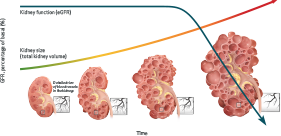 Kidney Function and TKV Over Time